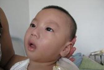 儿童抽动症都有哪些表现呢?